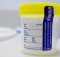 urine-cup-test-11080802